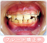 ̃v[guł̋×