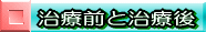 ��r�f�[�^�[�Ŕ[�����ĖႦ�邩�ȁH�E�E�E�E�E